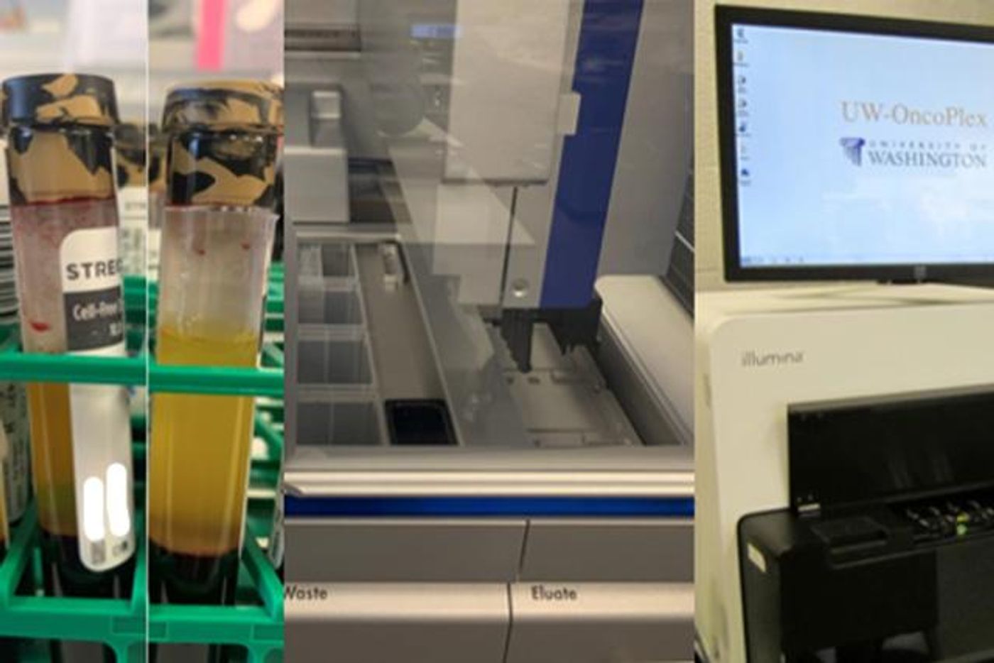 A set of images show the UW-OncoPlex cell-free DNA, or "liquid biopsy" work flow at the Genetics and Solid Tumors laboratory at University of Washington Medical Center in Seattle. The special cell-free DNA blood collection tubes on the left have been spun down. The top yellow portion is the plasma. / Credit: Colin Pritchard/UW Medicine