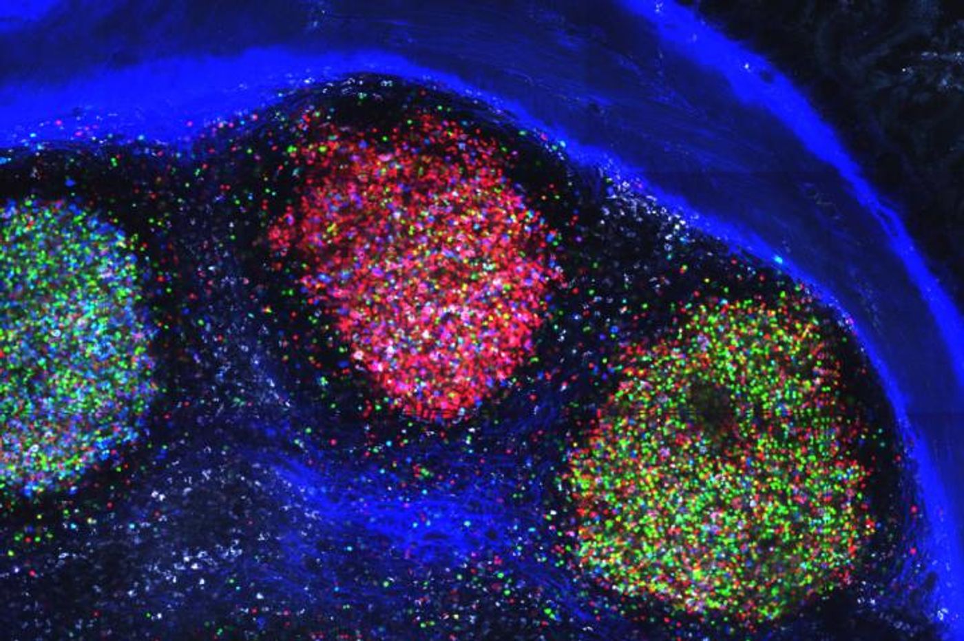 A large, multi-colored collection of germinal centers observed in the mesenteric lymph node of a mouse. / Credit: Laboratory of Lymphocyte Dynamics of The Rockefeller University