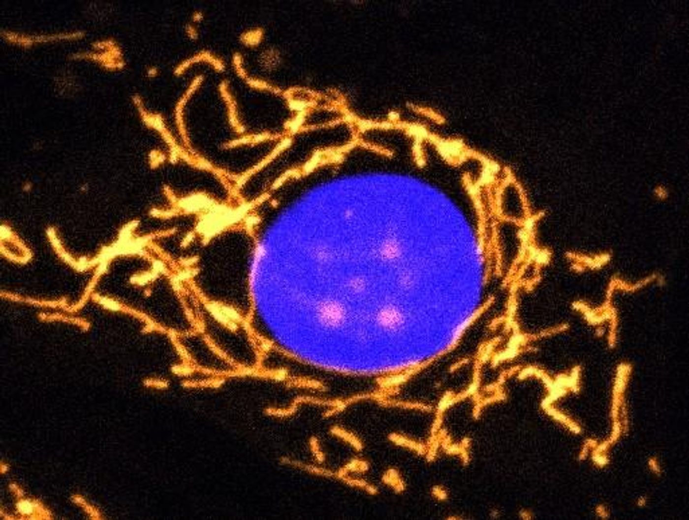A fluorescent microscope image with mitochondria highlighted in gold. This healthy cell shows a highly elaborate and well-connected network of mitochondria. Credit  Professor Jane Farrar and Dr Daniel Maloney, Trinity College Dublin