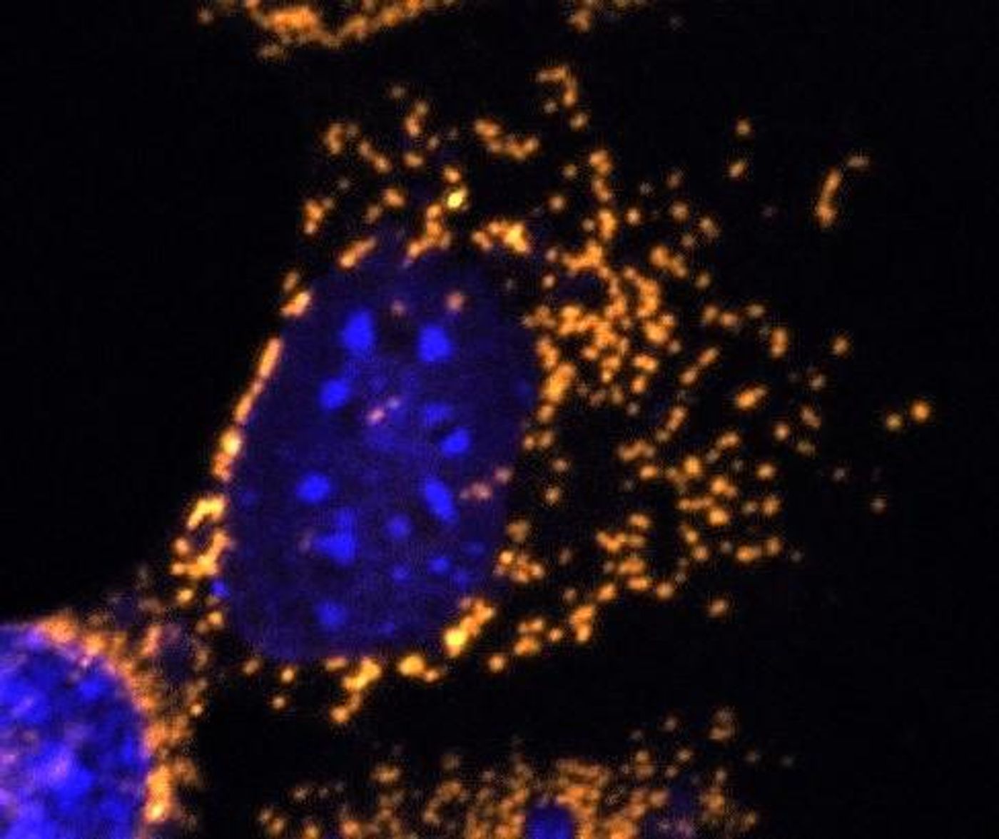 A fluorescent microscope image with mitochondria highlighted in gold. This cell completely lacks OPA1 protein and shows fragmented mitochondria. Credit  Professor Jane Farrar and Dr Daniel Maloney, Trinity College Dublin