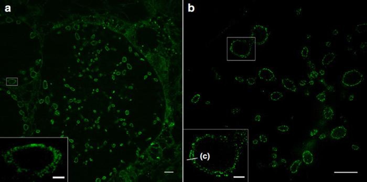 Sphingolipid ExM of 10X expanded chlamydia-infected cells. Bacterial membranes (green), distinguishing inner & outer bacterial membranes (c). In (a) confocal laser scanning and (b) SIM. Scale bars: 10 & 2 microns in the small white rectangles respectively. / Credit: Image: Sauer group / University of Würzburg