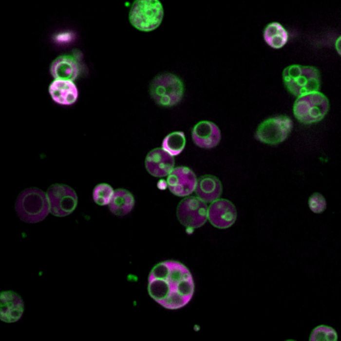 Membrane-separated compartments are visible inside the peroxisomes of 4-day-old Arabidopsis thaliana plant cells in this confocal microscopy image. The cells were genetically modified to produce fluorescent proteins in both the membranes (green) and lumen (magenta) of the peroxisomes. / Credit: Image courtesy of Zachary Wright/Rice University
