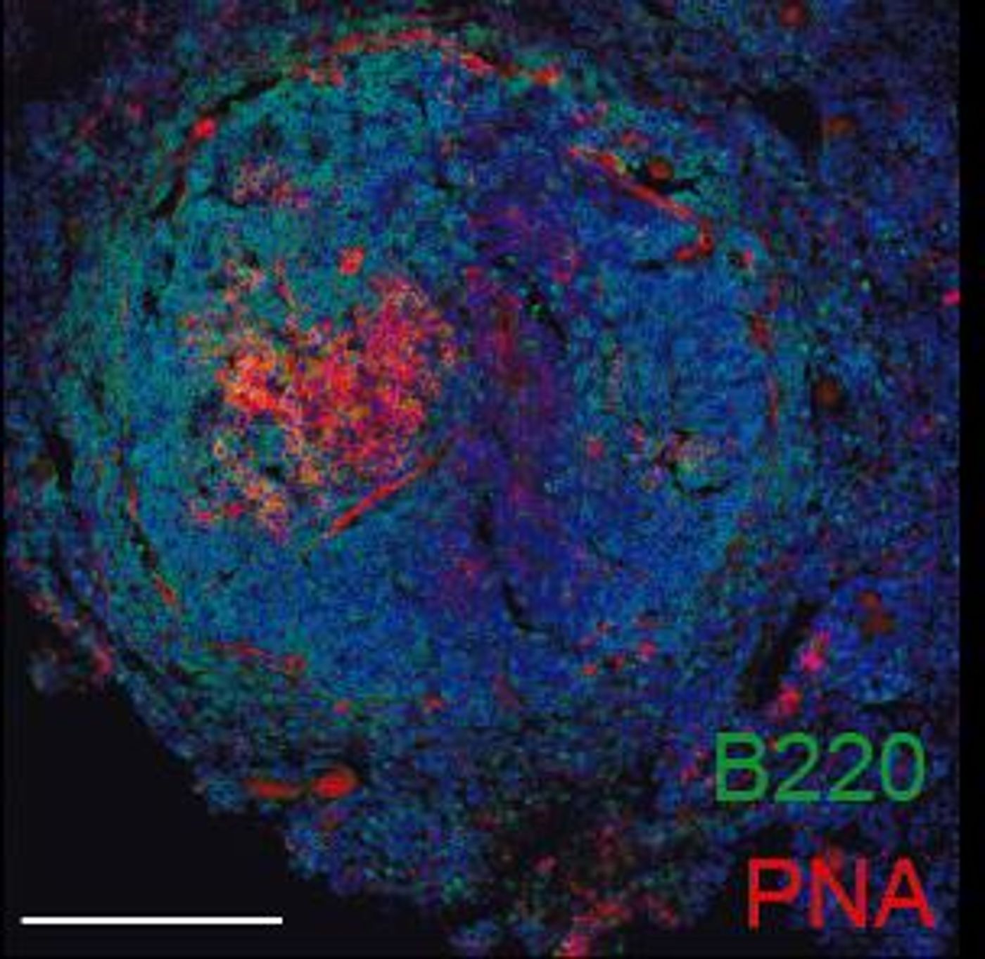 Germinal center response (red) in the spleen of an atherosclerosis-prone mice.  CREDIT CNIC