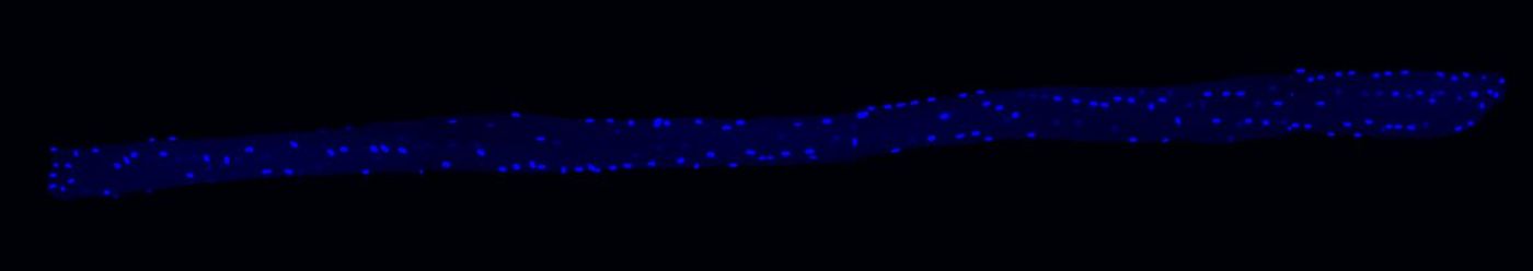 DAPI stain highlights many (blue) nuclei in one muscle fiber. / Credit  C.Birchmeier Lab, MDC