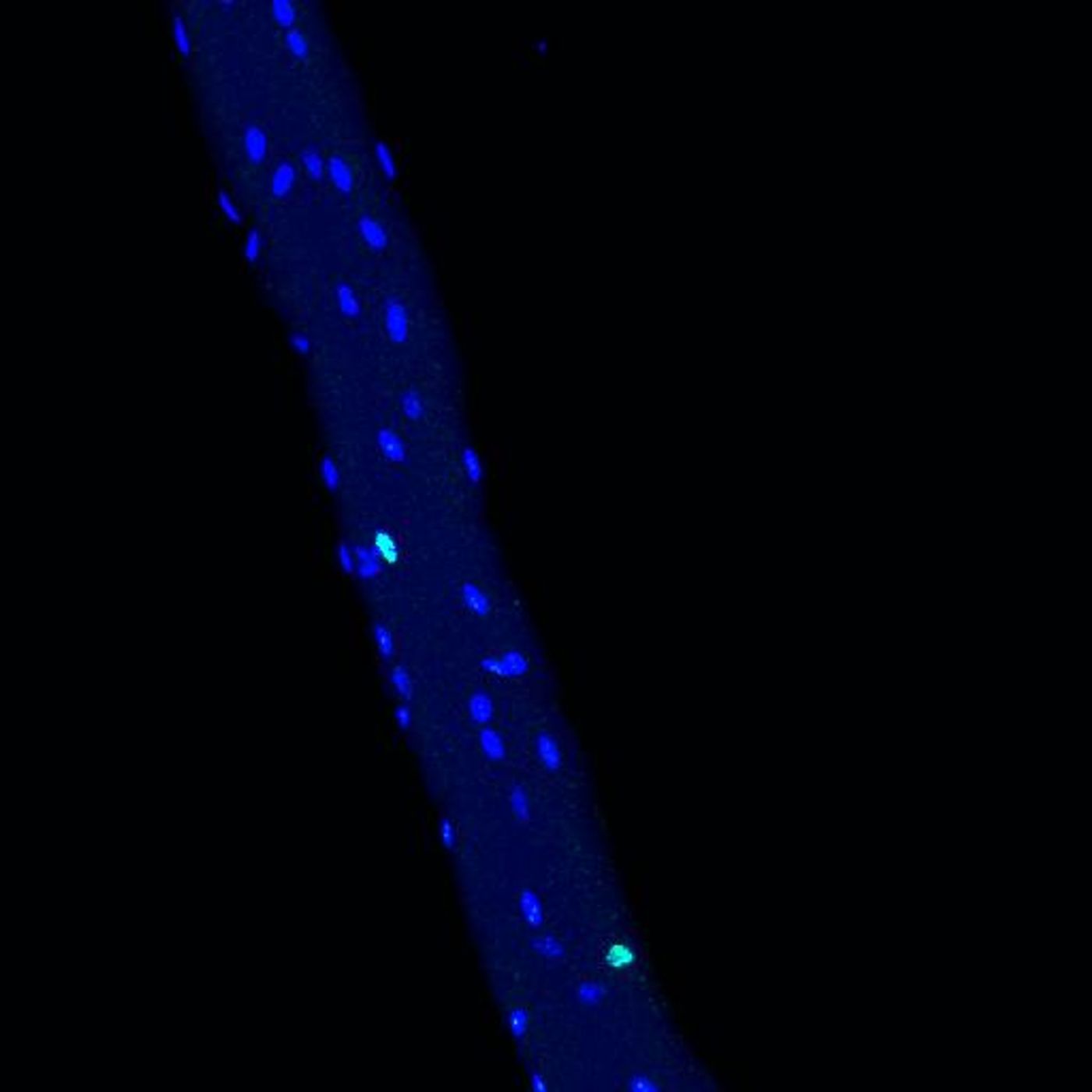 In this part of a muscle fiber, Rian was stained as well. Rian is a long, non-coding RNA (lncRNA) that is highly expressed in a cluster. This indicates that the nuclei have a function in metabolism of the cell. / Credit  C.Birchmeier Lab, MDC