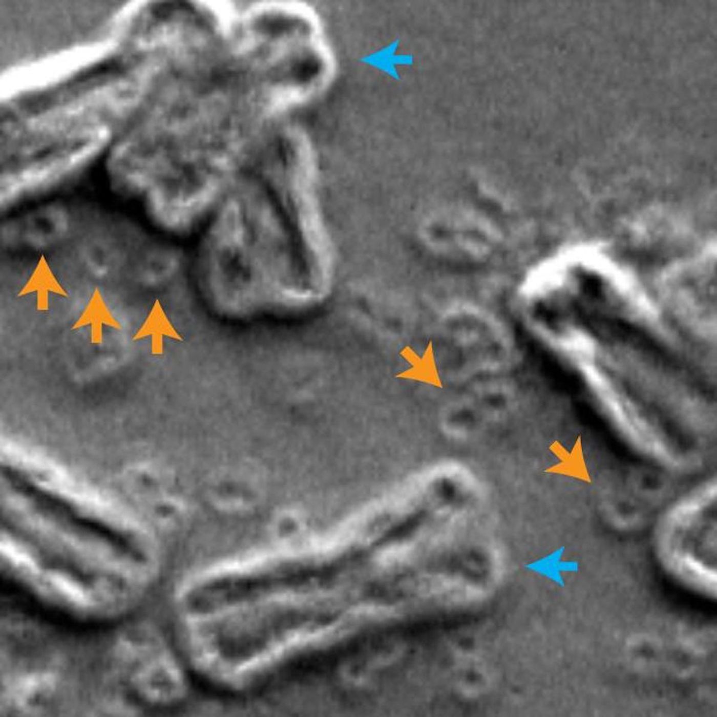 n this scanning electron micrograph of inside the nucleus of a cancer cell, chromosomes are indicated by blue arrows and circular extra-chromosomal DNA are indicated by orange arrows. / Credit: Image courtesy of Paul Mischel, UC San Diego