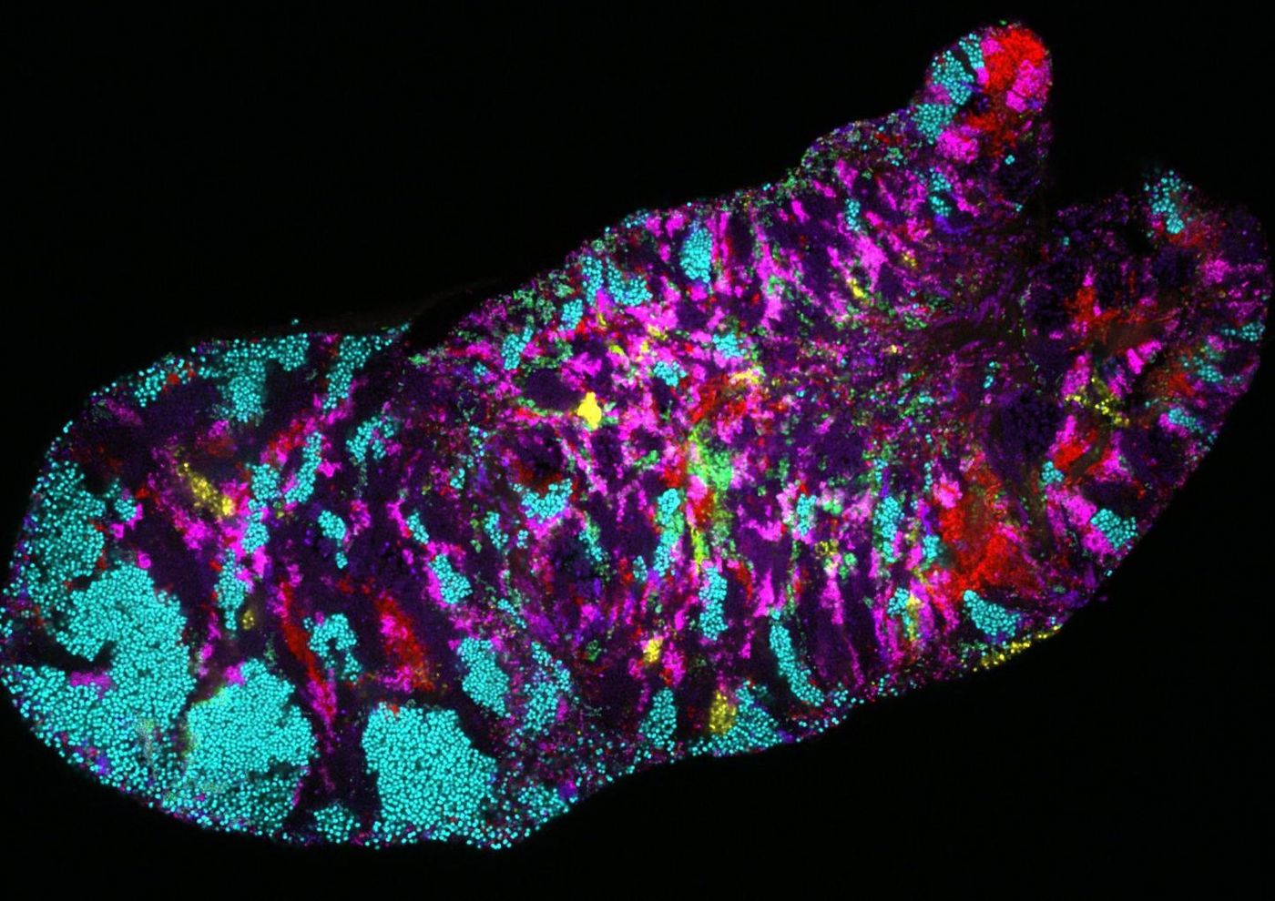 Micrograph showing Rothia cells (light blue) in their native habitat, a bacterial biofilm scraped from the human tongue. /  Photo credit: Jessica Mark Welch, Marine Biological Laboratory.