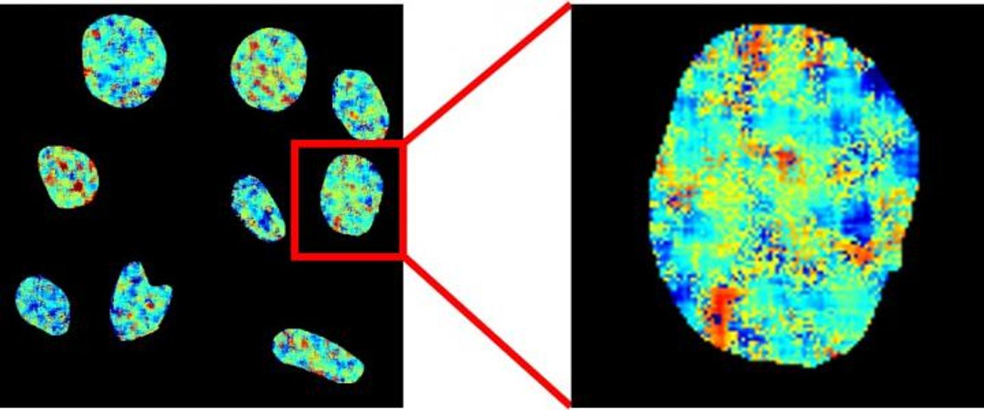 Fluorescence lifetime imaging microscopy map of nuclear DNA in live cells stained with the new probe. Colours represent fluorescence lifetimes between 9 (red) and 13 (blue) nanoseconds / Credit: Imperial College London