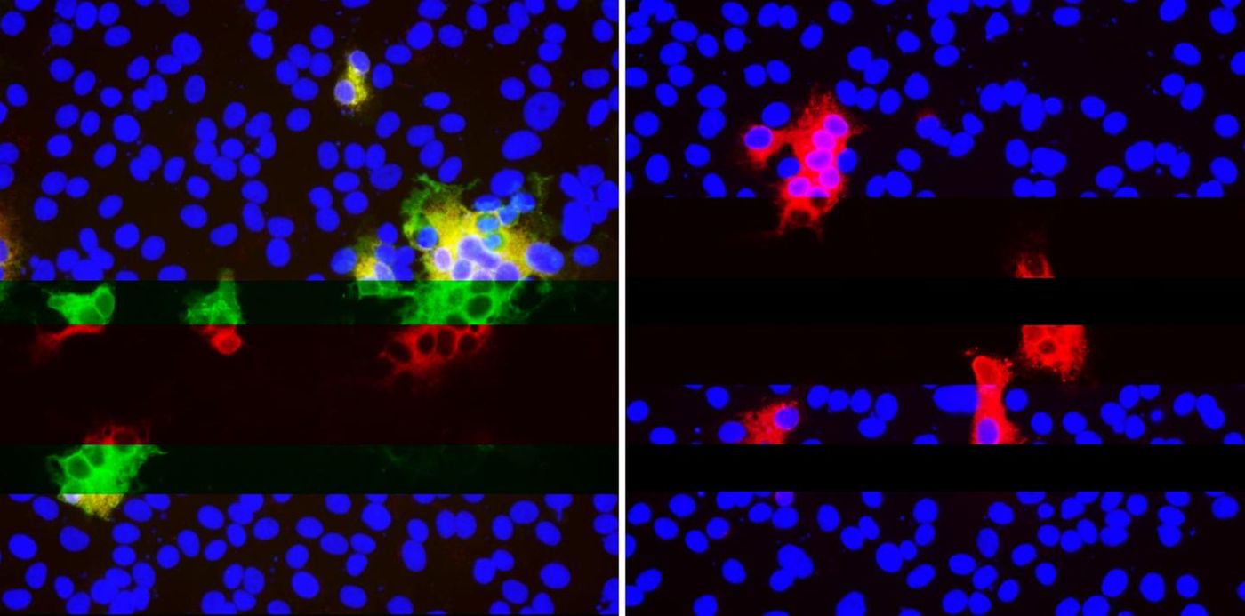 Multiple antibodies (green and red) bind SARS-CoV-2 spike protein in cells (nuclei in blue) when there are no deletions (LEFT). Deletions in spike protein stop neutralizing antibody binding (lack of green) but other antibodies (red) still attach well (RIGHT). / Credit: Kevin McCarthy and Paul Duprex