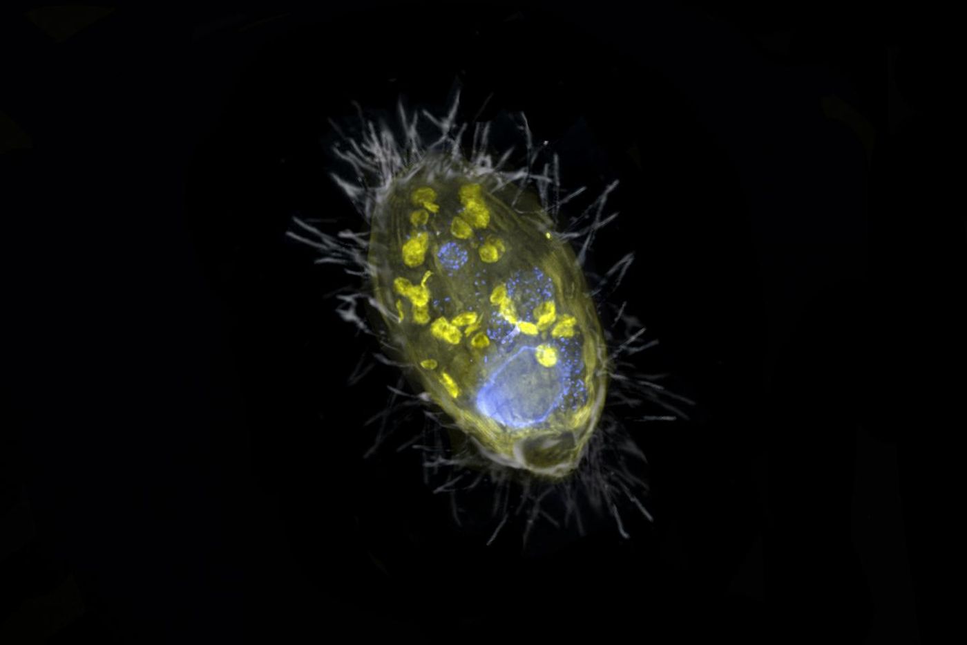 The 'Candidatus Azoamicus ciliaticola' endosymbiont (yellow), large nucleus (blue) and bacterial prey in food vacuoles. The outer structure of the fluorescent ciliate and the cilia are also visible in this merge of a grey scanning electron microscope image and fluorescence images. / Credit: Max Planck Institute for Marine Microbiology, S. Ahmerkamp