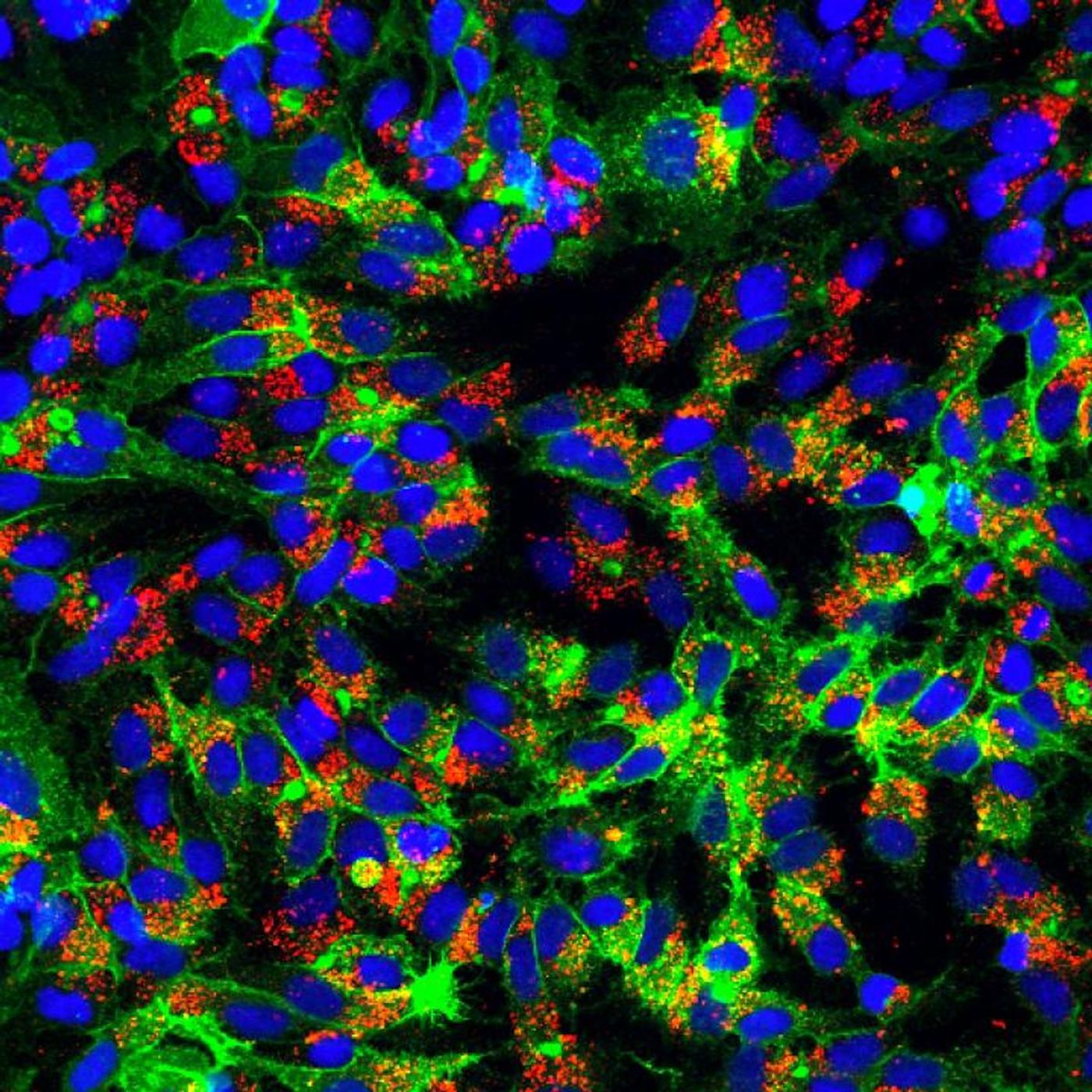 Human liver cell lines (green, with blue nuclei) infected with HBV express an HBV protein (in red) in this image captured by immunofluorescence microscopy. / Credit: Image by Stephanie Maya, Princeton University