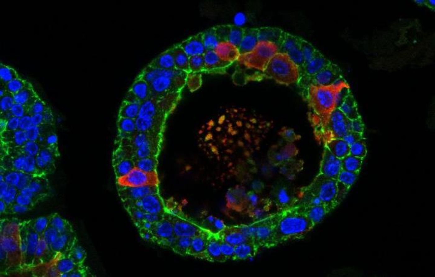 Lipocalin 2 (in red) is a tear component that is made by the organoids. / Credit: Yorick Post, copyright Elsevier