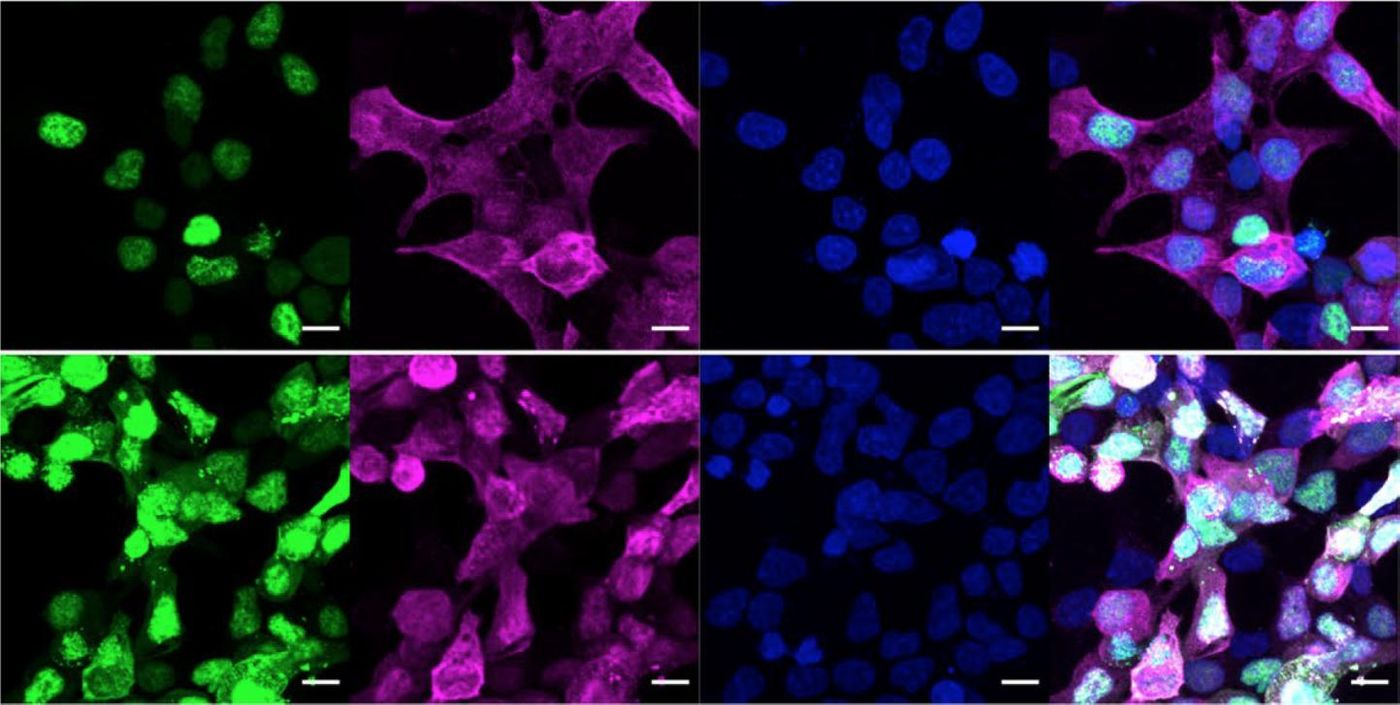 The last image in this panel shows the merged enzymes don't affect where proteins are located in the cell, suggesting that these tools do not cause any off-target effects. / Credit: Courtesy of the Woo lab