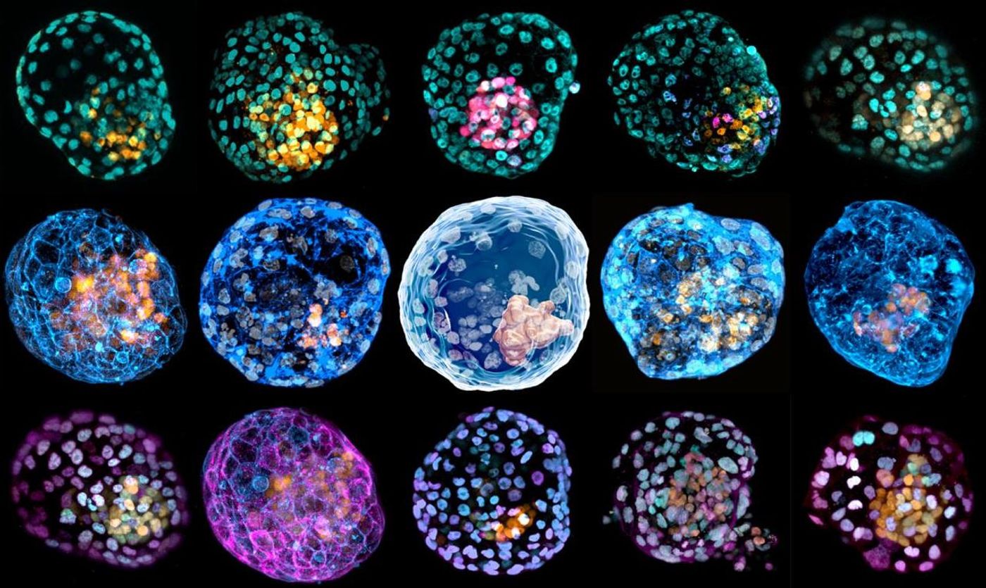 Images of iBlastoids with different cellular staining / Credit: Monash University