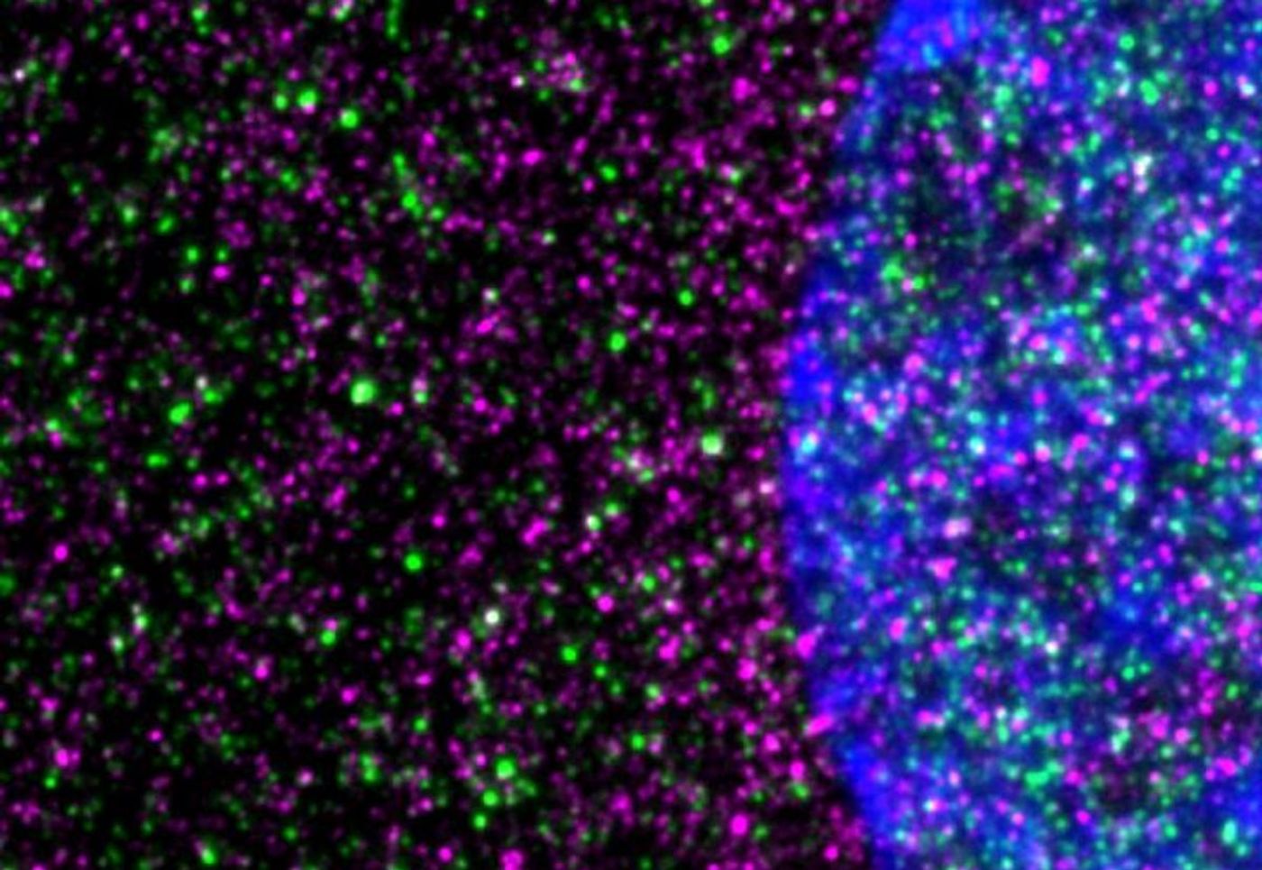 Disease-causing huntingtin, shown in red, interacts with ribosomes, shown in green, in a striatal neuron. The nucleus is blue. Credit  Image by Nicolai Urban of Max Planck Institute for Neuroscience in Jupiter, Florida