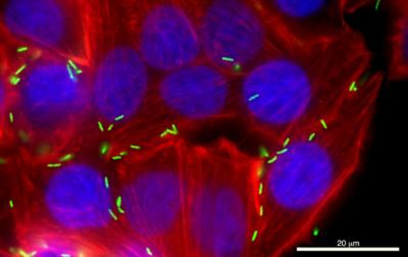 Campylobacter jejuni (green) is shown infecting a human cell. / Credit: WSU