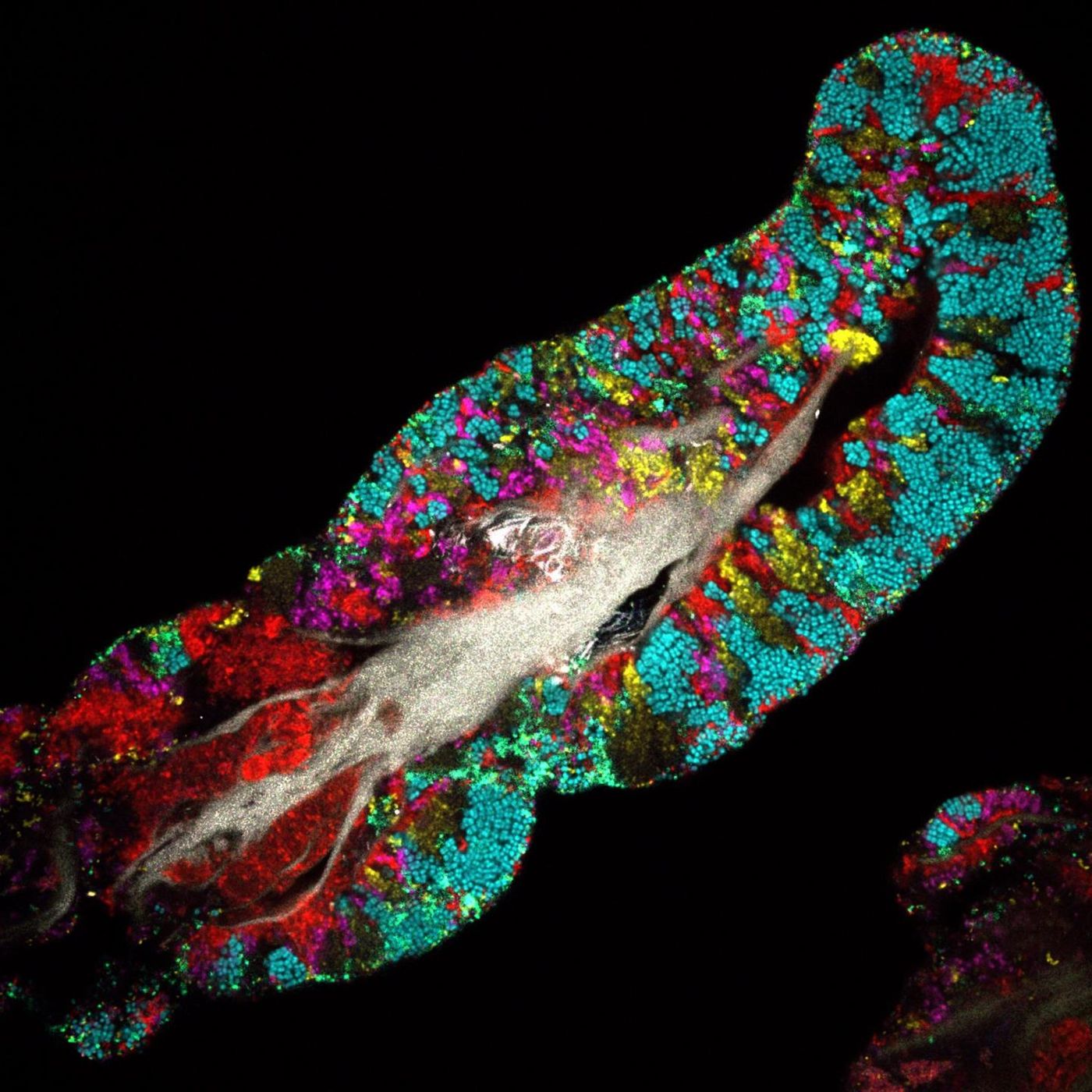 Each color represents a different type of microbe. The white material in the core represents the remnants of human tongue cells about which the microbes grow. / Credit: Steven Wilbert, Gary Borisy, Forsyth Institute; Jessica Mark Welch, Marine Biological Laboratory