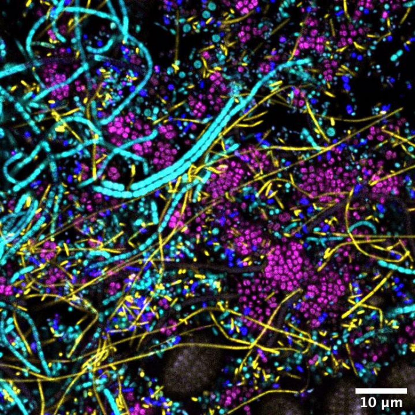 Each dot or filament is a bacterial cell and the different colors indicate different kinds of bacteria. The larger, ridged ovals are single-celled algae called diatoms. / Credit: Tabita Ramirez-Puebla and Jessica Mark Welch, Marine Biological Laboratory