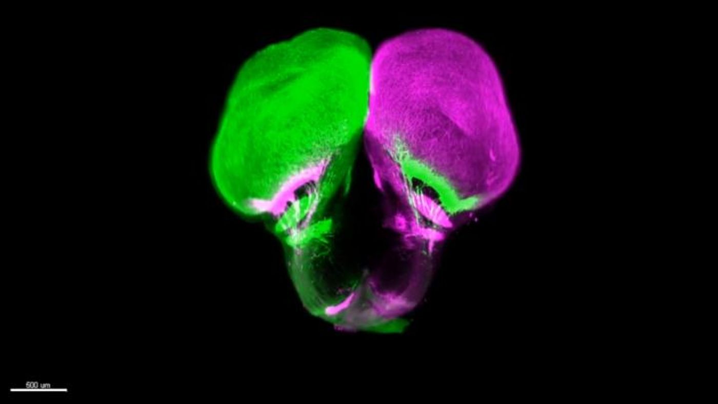 The gar's brain. The brain's left hemisphere (green) and the right (magenta). At the bottom, nerves of both colors can be seen connecting to both hemispheres, showing that both of the gar's eyes are connected to both sides of its brain, like in humans. / Credit: Reprinted with permission from R.J. Vigouroux et al. Science 372:eabe7790 (2021)