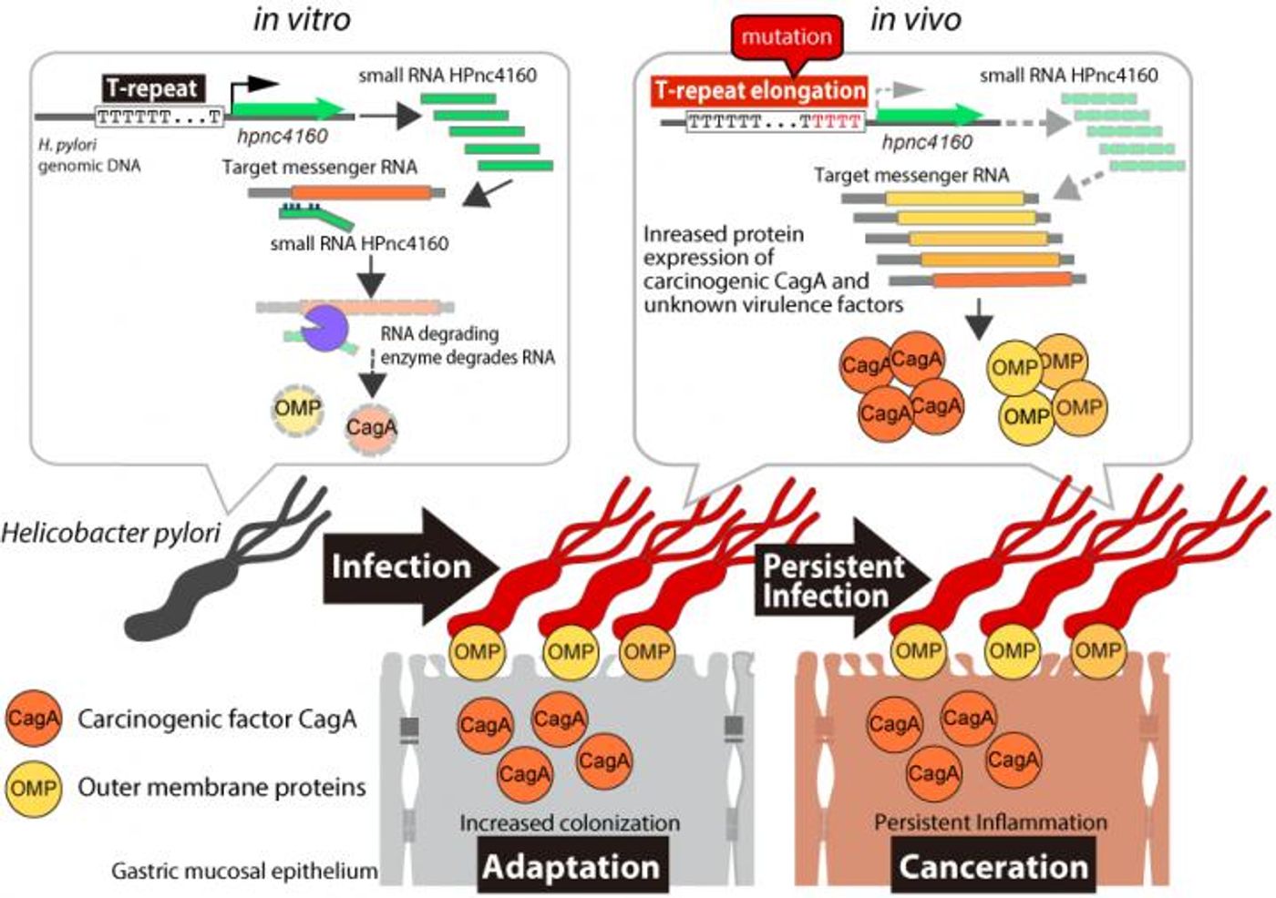 Persistent infection and, potentially, cancer development are regulated by H. pylori small RNA HPnc4160. Gastric mucosa-infecting H. pylori carry a mutation in a T-repeat sequence upstream of the HPnc4160 gene. As HPnc4160 then decreases, pathogenic factors increase, enabling to H. pylori to easily infect the gastric mucosa for a long period of time. / Image credit: Osaka University