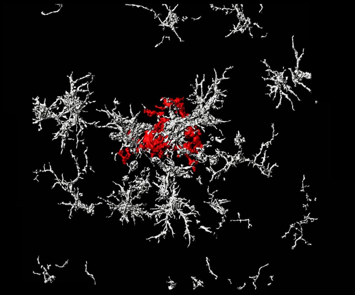 A dense-core amyloid-beta plaque (red) surrounded by microglia that lack TAM receptors (white) in the brain of a mouse with Alzheimer's disease / Credit: Salk Institute