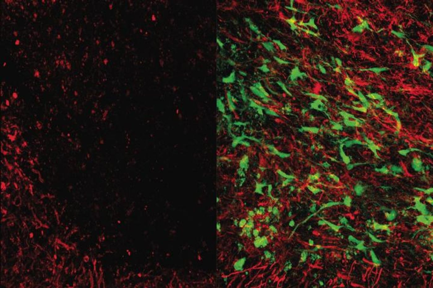Brain tissue that's been damaged by white matter stroke (left) and treated with glial cell therapy (right). Myelin (red) protects neuronal connections and is in a white matter stroke. Glial cell therapy (green) helps restore lost myelin, improves connections. Credit: UCLA Broad Stem Cell Research Center/Science Translational Medicine