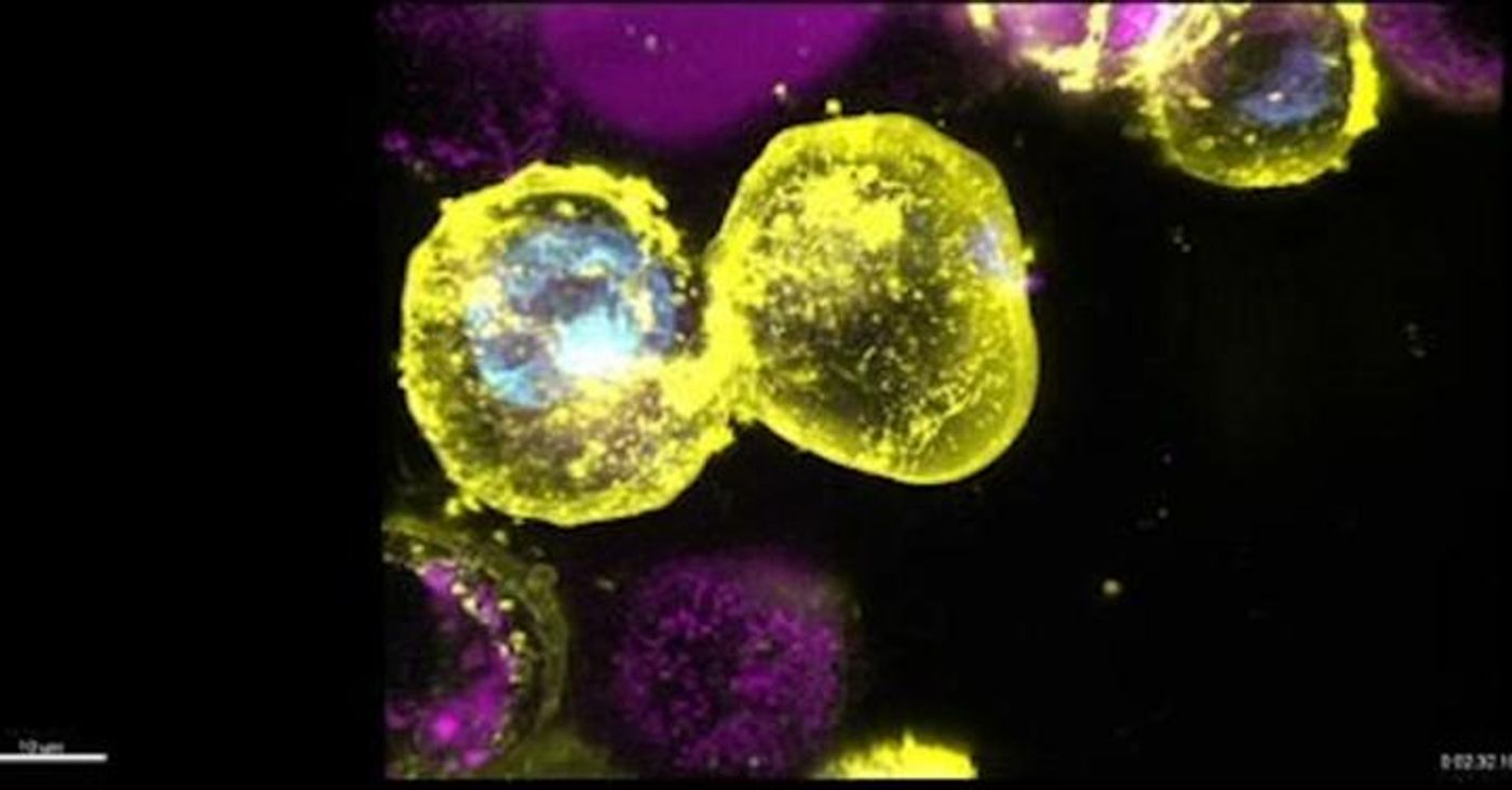 A cell in yellow is shown dying by necroptosis, a process requiring the protein MLKL Credit: WEHI Australia