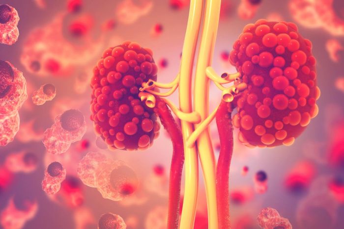 3D illustration of kidney disease which now affects 10 per cent of the world's population due to a spike in obesity, leading to diabetes. / Credit: University of South Australia