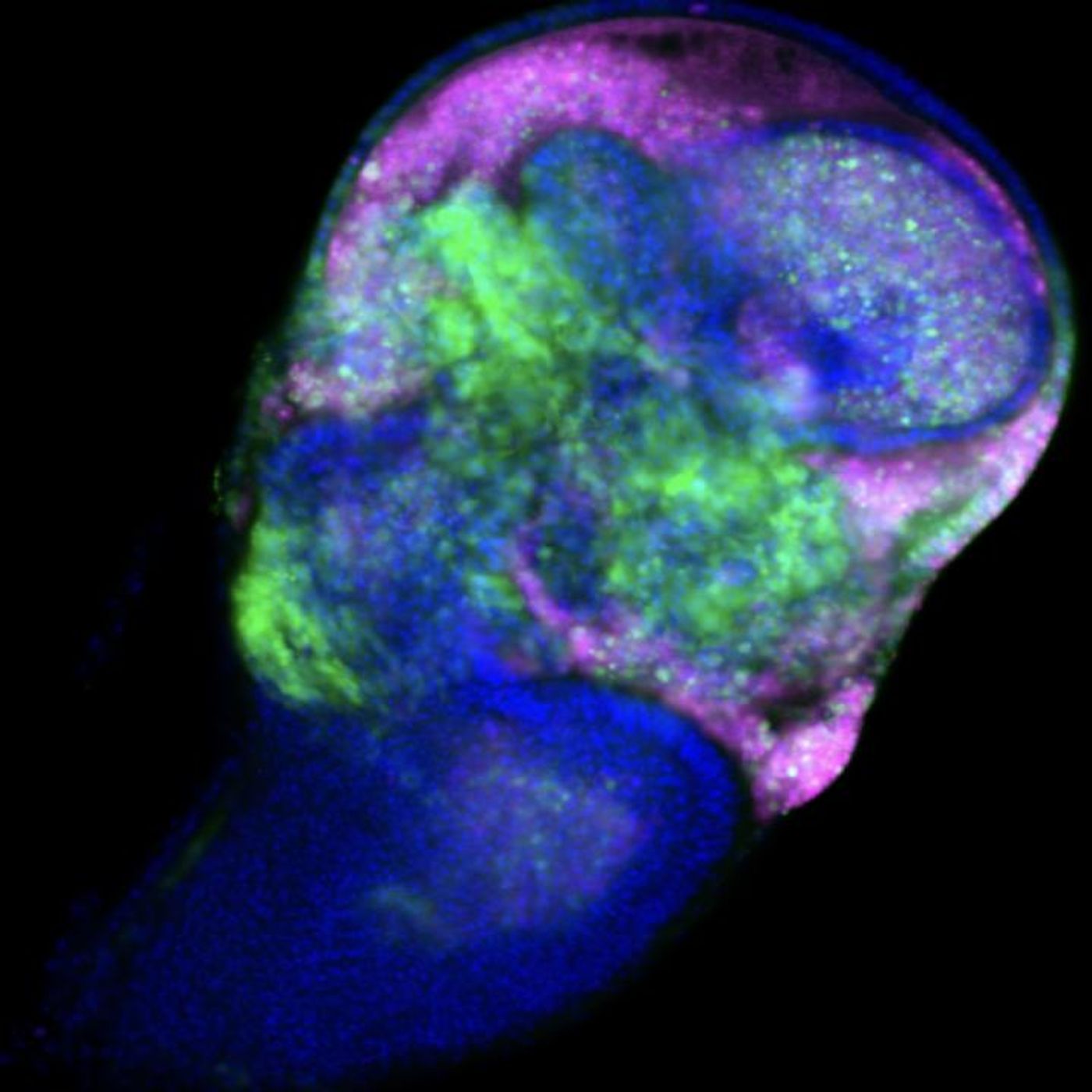 This picture shows the wing imaginal disc of fruit fly. Green cells are live and proliferating cells that express an oncogene Src. Magenta cells are dying cells due to Src expression. Thus, Src promotes proliferation (green) and cell death (magenta) simultaneously. / Credit: RIKEN