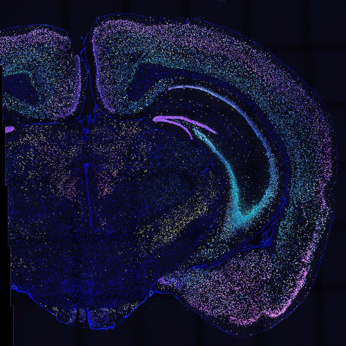 BARseq2 detects dozens of genes in thousands of neurons in this mouse brain slice. Each color lights up a different set of genes. / Credit: Chen and Sun/Zador lab, CSHL/2021