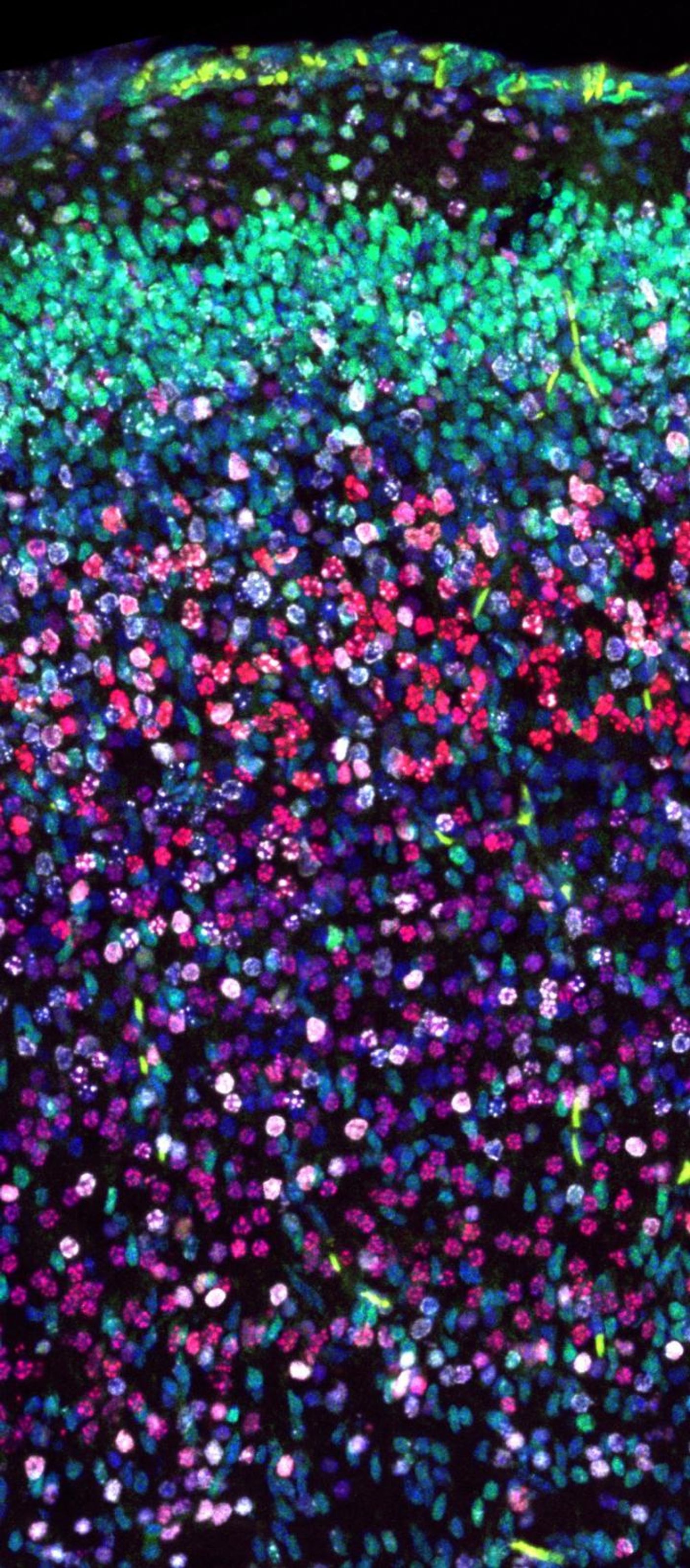 Immunofluorescence staining allows scientists to study the migrating cells (white) in the mouse brain. / Credit: © IST Austria