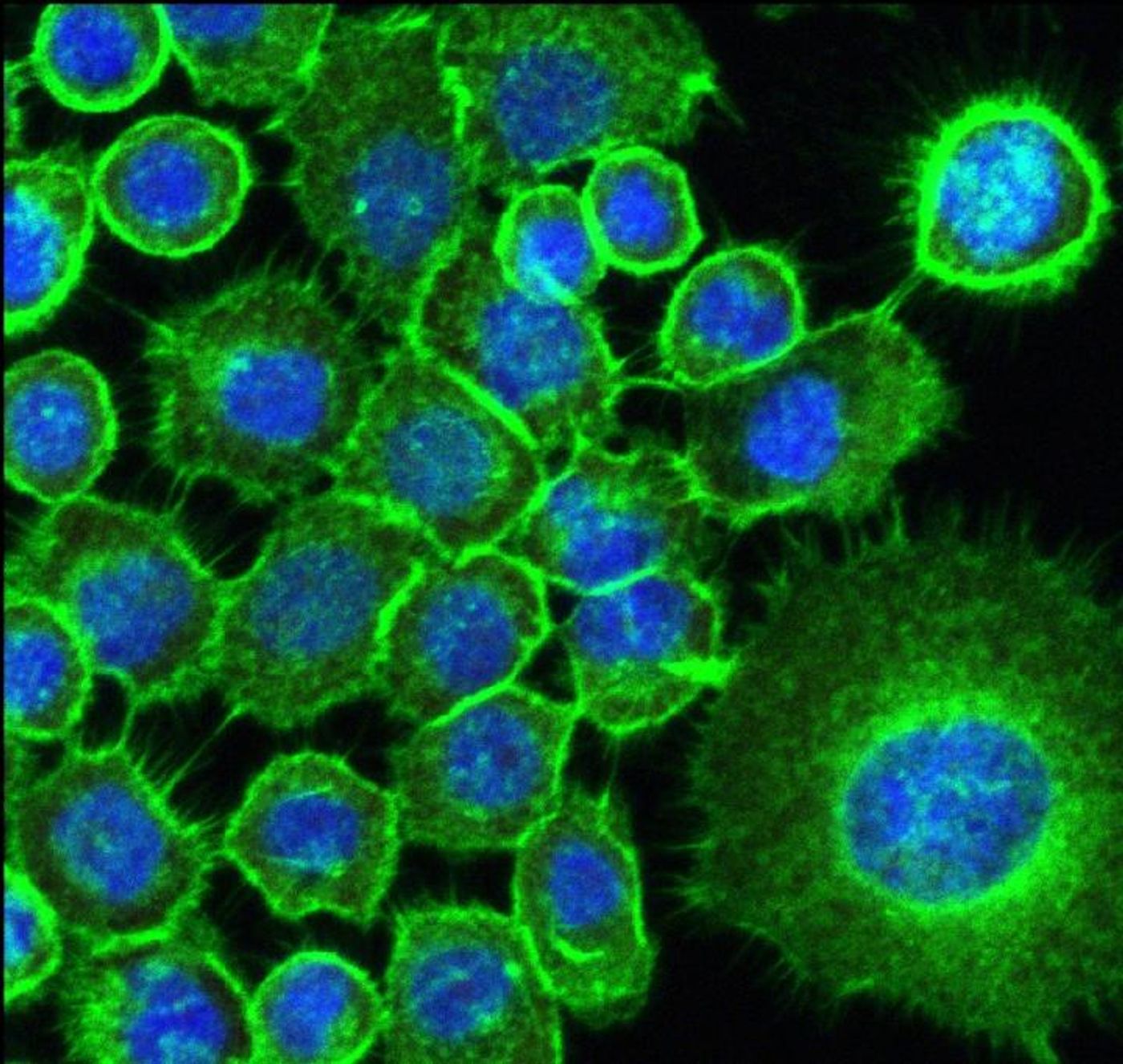 SCC25 cell stimulated with metabolites of C. albicans biofilm seen under confocal microscope / Credit: FOAr-UNESP