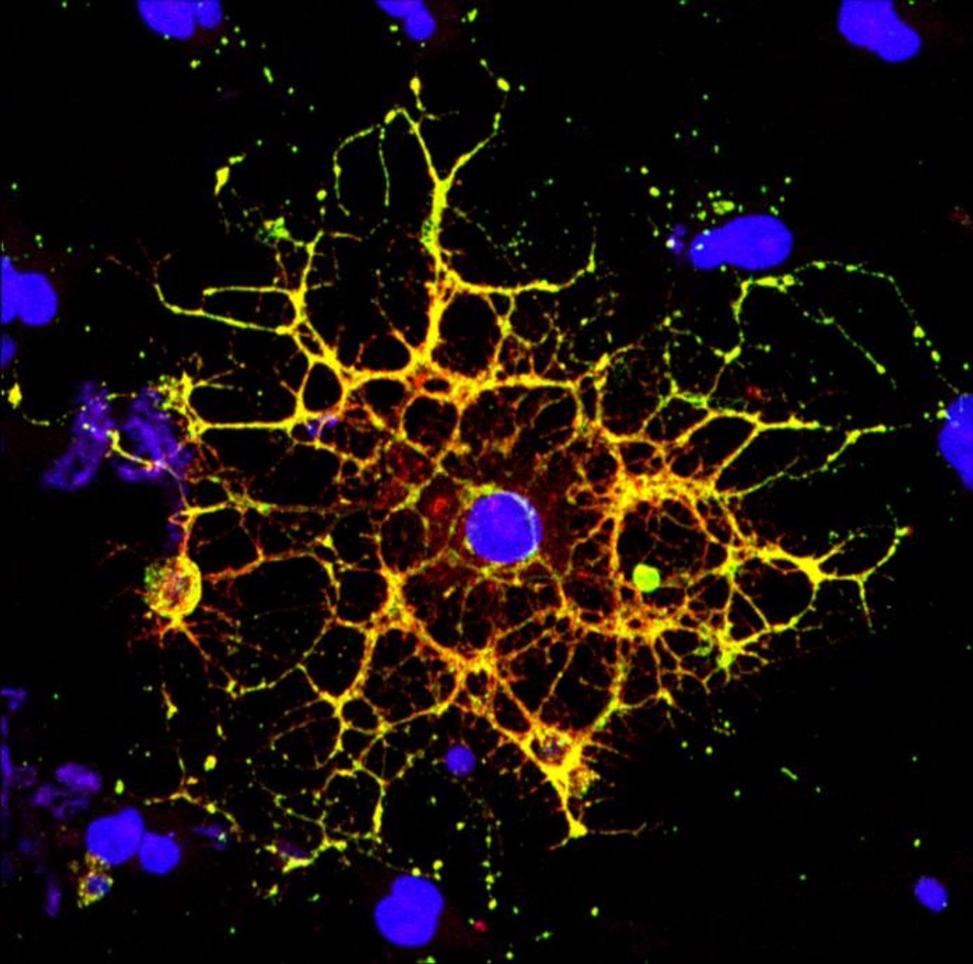 This confocal microscope image shows an oligodendrocyte in culture; the nucleus (blue),  and myelin proteins (red, green, and yellow) are highlighted./ Credit: Raj Putatunda