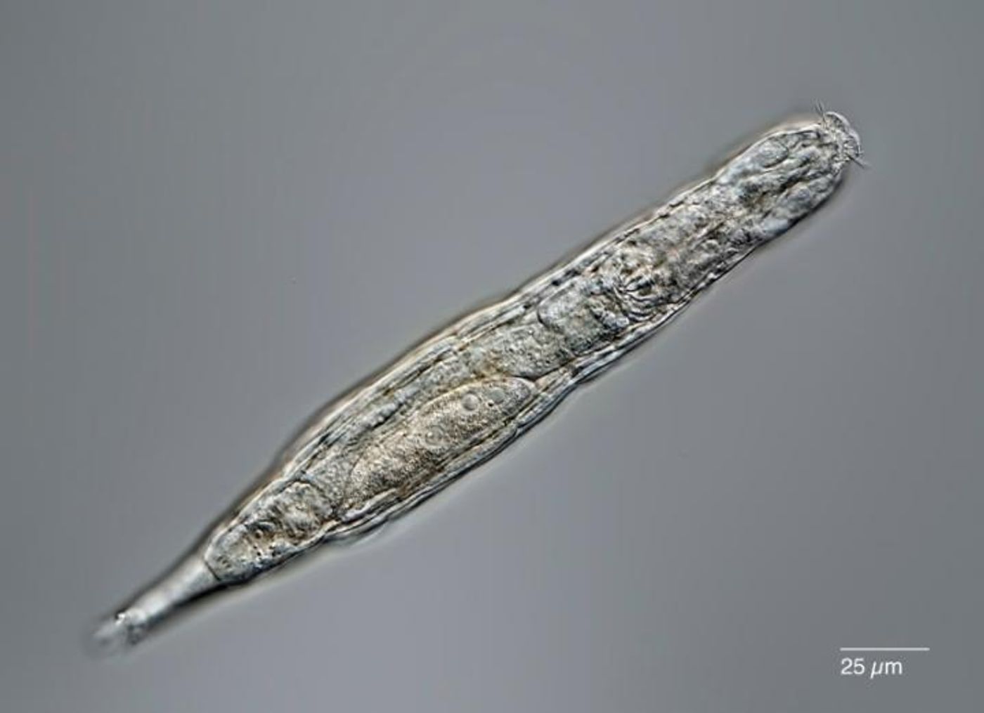 This image shows a rotifer. / Credit: Michael Plewka