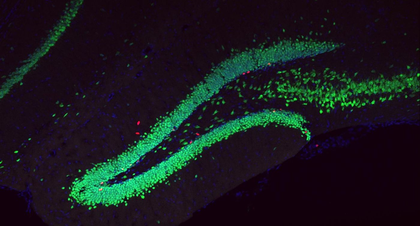 This image shows neurons (greeen) and nascent cells (red). Pink cells are new neurons. / Credit: © UNIL-CHUV- Carron / Toni