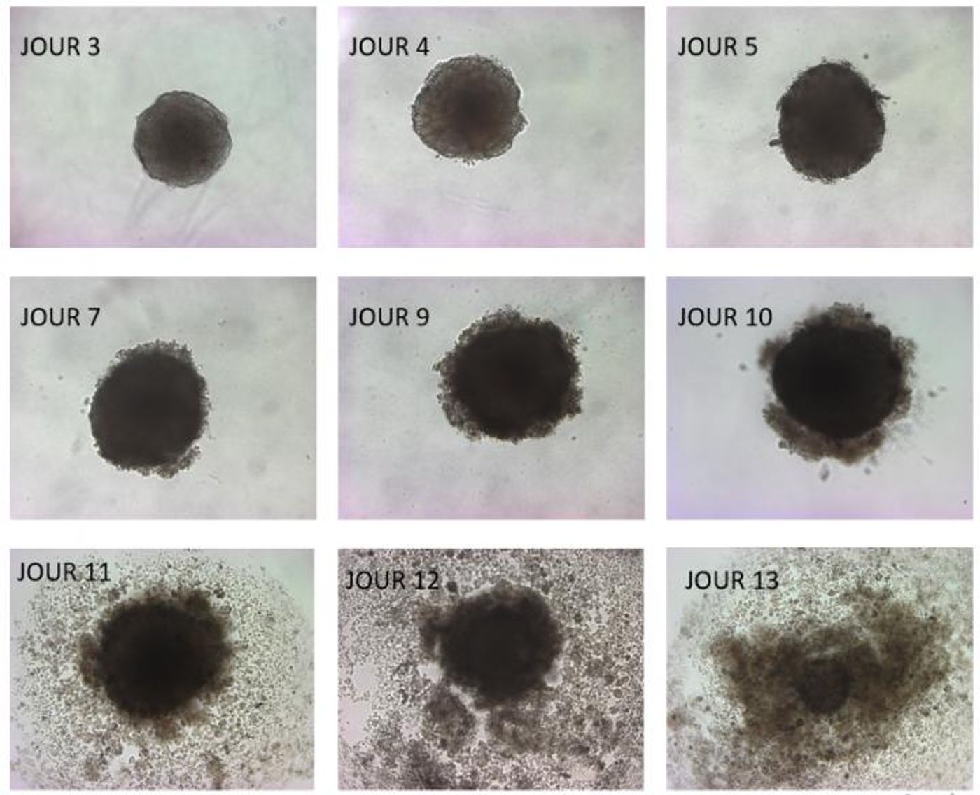 3D tumors disintegrate within days after exposure to omega-3 DHA, found mainly in fish. Tumor cells in acidosis take up fatty acids like DHA but can't store it, which poisons them to death. / Credit: Copyright UCLouvain