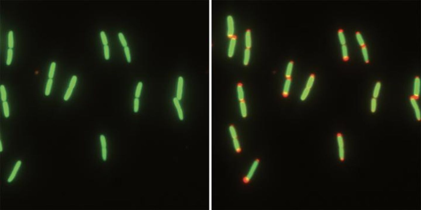 E. coli cells go from nutrient-rich (left) to nutrient-free conditions (right). The cytoplasm (green) and the periplasm (red) can be seen. / Credit: Kerwyn Casey Huang laboratory, Stanford University