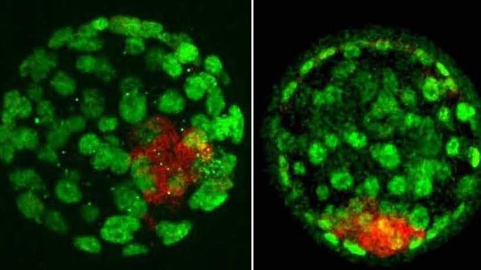 (L) A normal 4-day-old mouse embryo. (R) An embryo with only maternal chromosomes (parthenogenote). The same-age embryos look similar now, but the parthenogenote will die soon, showing that imprinted genes must be inherited from both parents. Green or red denotes different cell types. / Credit: Dr Maki Asami, University of Bath