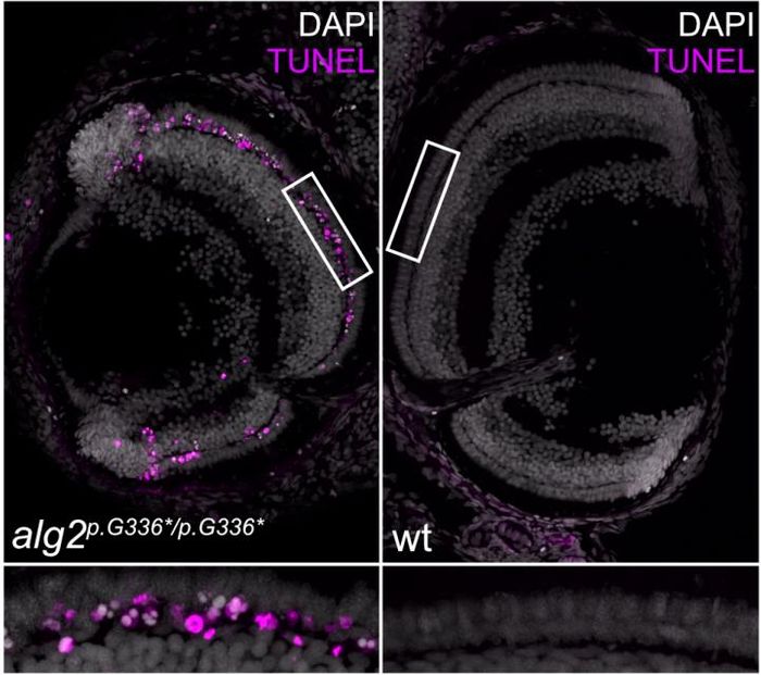 ALG2 mutant medaka fish retinas show progressive loss (magenta) of rod cells (left), normal fish do not. / Credit: Clara Becker