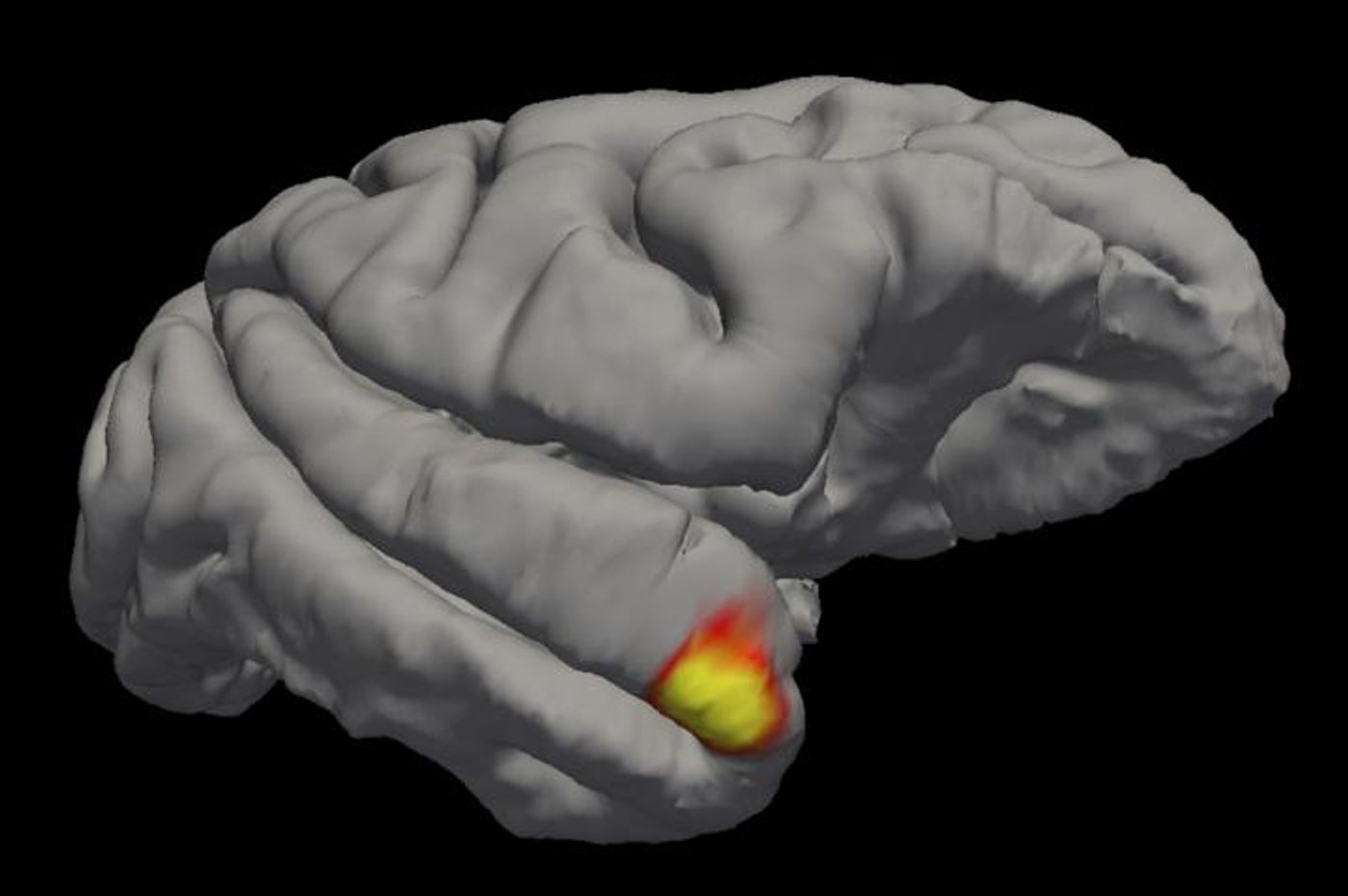An area (red-yellow) in the brain's temporal pole specializes in familiar face recognition. / Credit: Sofia Landi