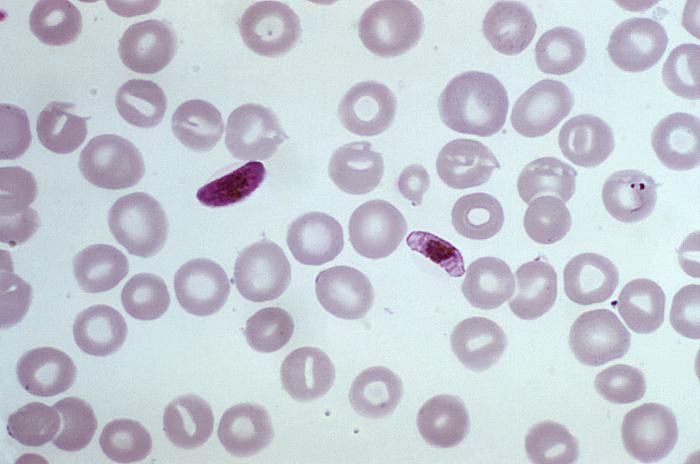 A photomicrograph of a blood smear revealing a macrogametocyte (right), and microgametocyte of the Plasmodium falciparum parasite. / Credit: CDC/ Dr. Mae Melvin