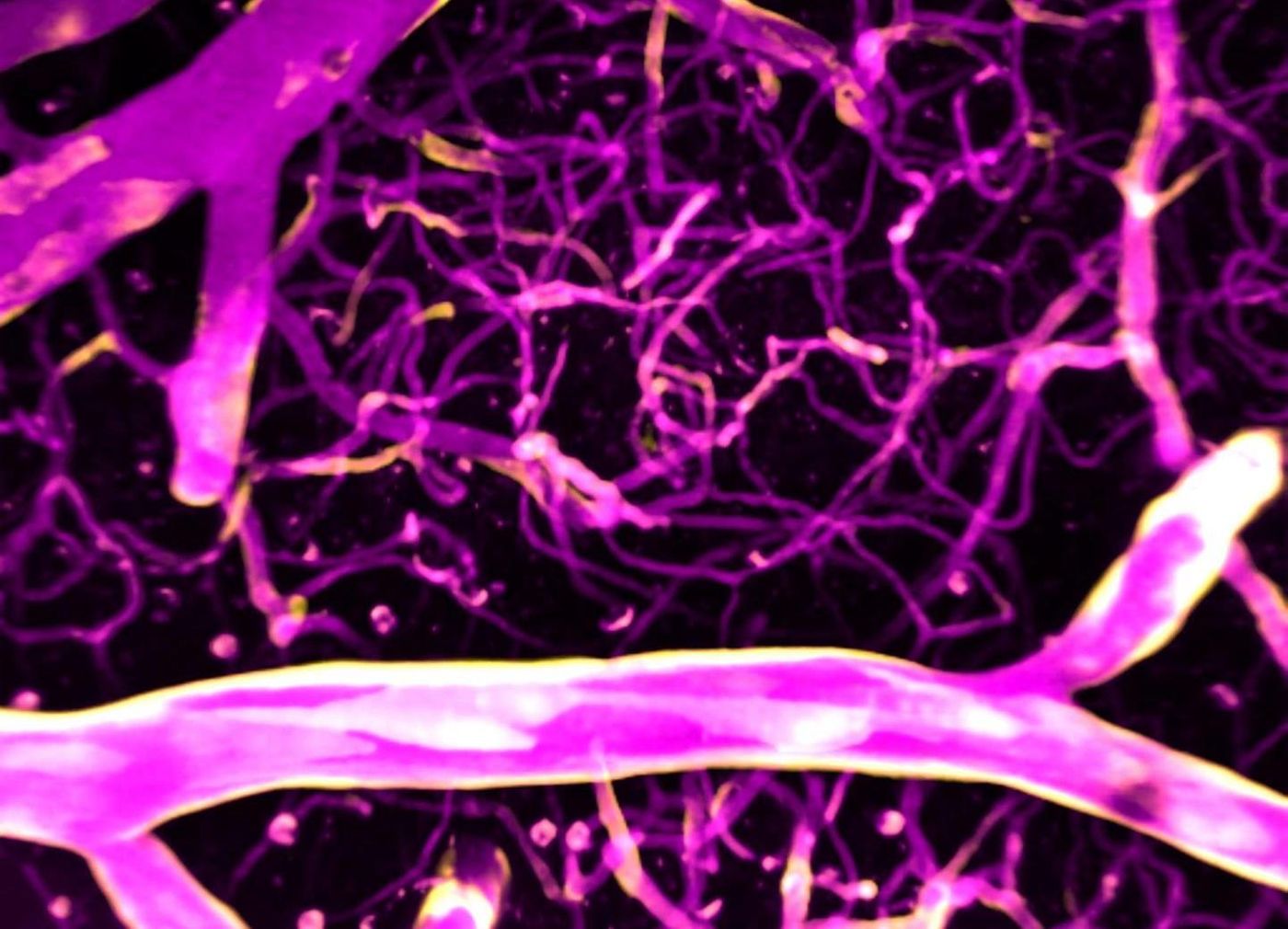 Calcium (pink) directs blood flow in the brain's blood vessels. / Credit: Thomas Longden