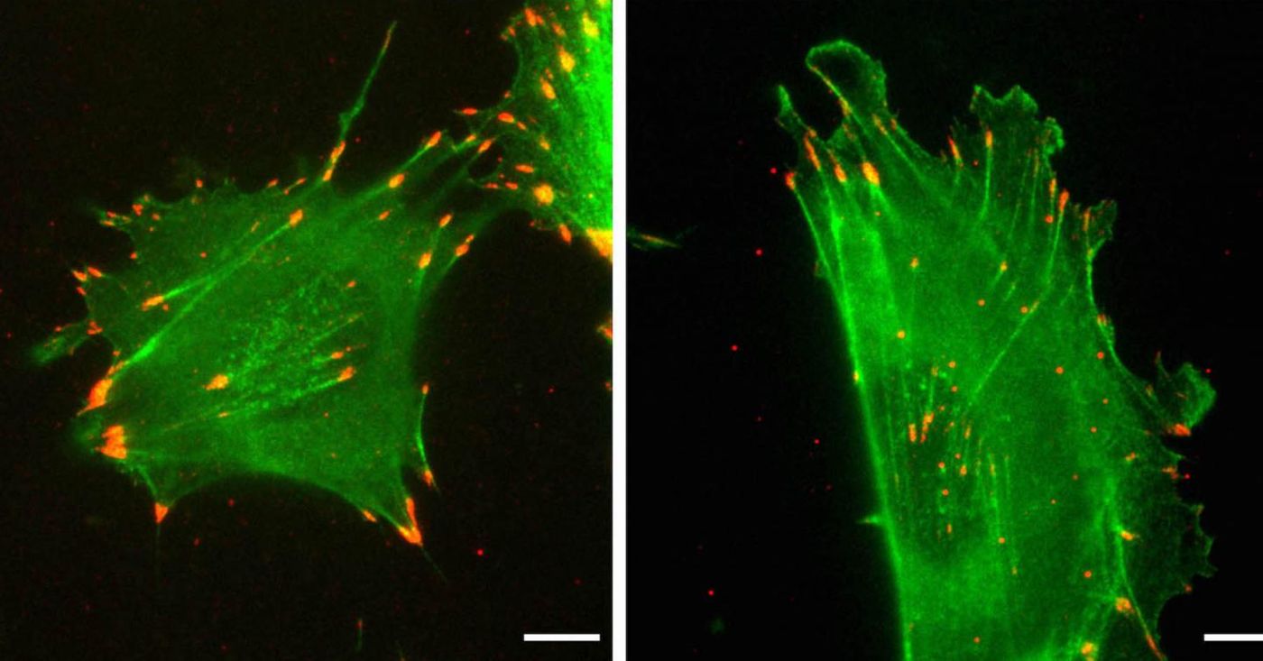 Image credit: Kashina Lab/University of Pennsylvania