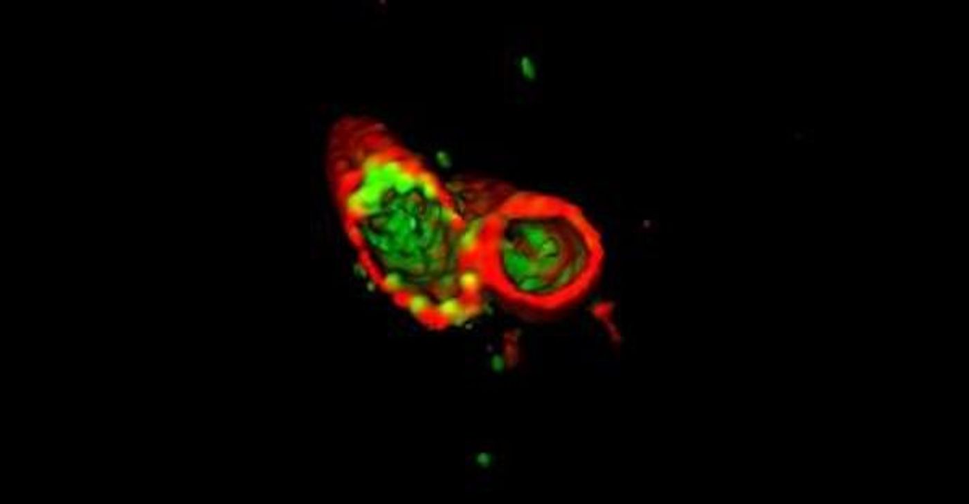 The cross section shows that before APOL3 (green) kills Salmonella, it has to penetrate the protective outer membrane (red) of the bacteria / Credit: R. Gaudet et al./Science 2021