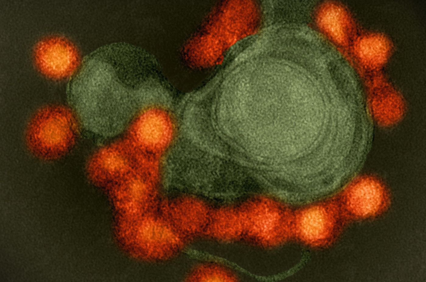  (Cropped) TEM image of a Fortaleza-strain Zika virus (red), isolated from a microcephaly case in Brazil. / Credit: National Institute of Allergy and Infectious Diseases, National Institutes of Health