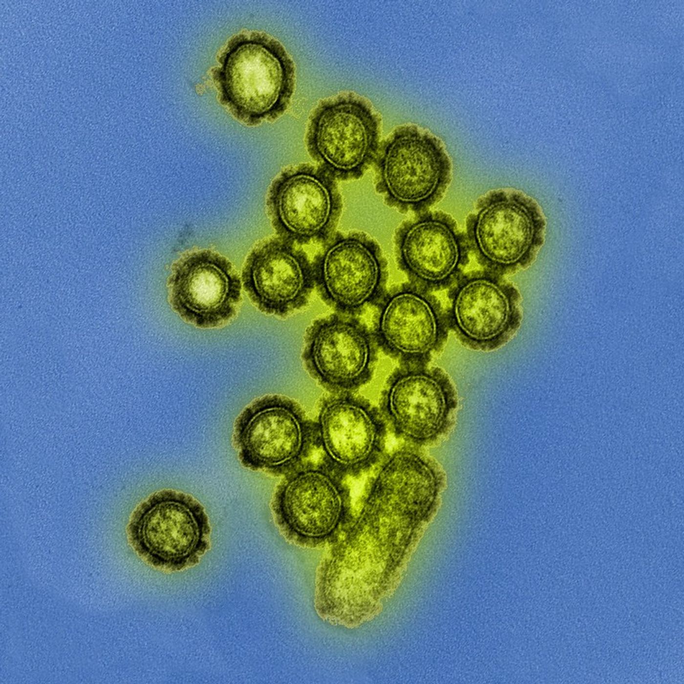   Colorized transmission electron micrograph showing H1N1 influenza virus particles. Surface proteins on the virus particles are shown in black.     Credit: National Institute of Allergy and Infectious Diseases, National Institutes of Health