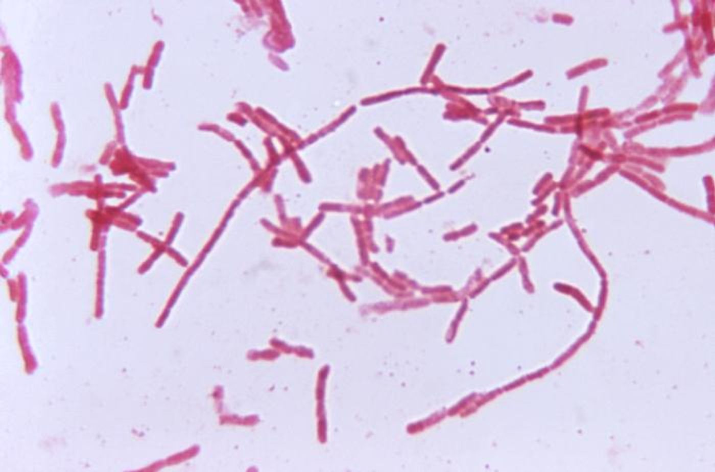 Bacteroides / Image credit: CDC/ Dr. V. R. Dowell, Jr.