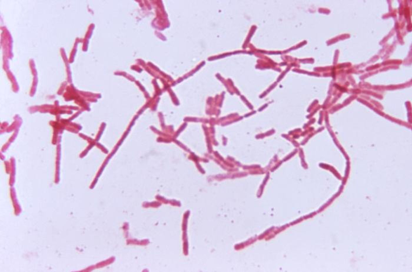 Bacteroides bacteria, which are mainly found in the intestine as normal flora. / Credit: CDC / Dr. V. R. Dowell, Jr.