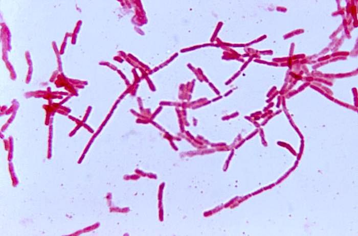 Bacteroides hypermegas after being cultured in a thioglycollate medium for a 48 hour time period. / Credit: CDC/ Dr. V. R. Dowell, Jr.
