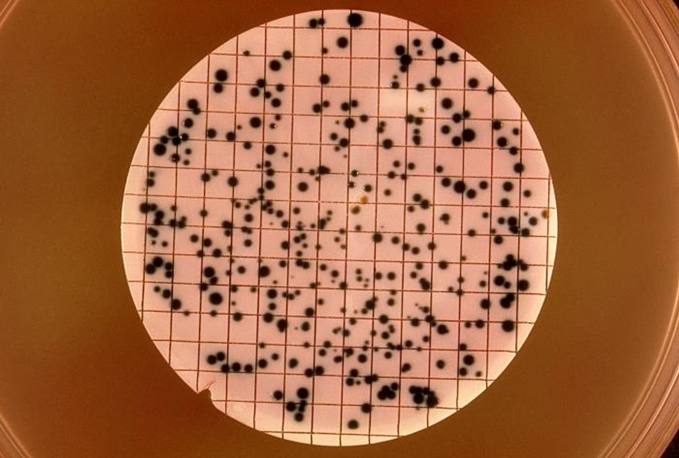  	 This image depicts what was a plate culture, which underwent a 40 hour incubation period, and after being stained with oxidase reagent, revealed these numerous, small, Neisseria gonorrhoeae colonies, the causative agent for gonorrhea.